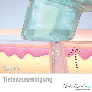 HydraFacial Behandlung Frankfurt Schritt 3